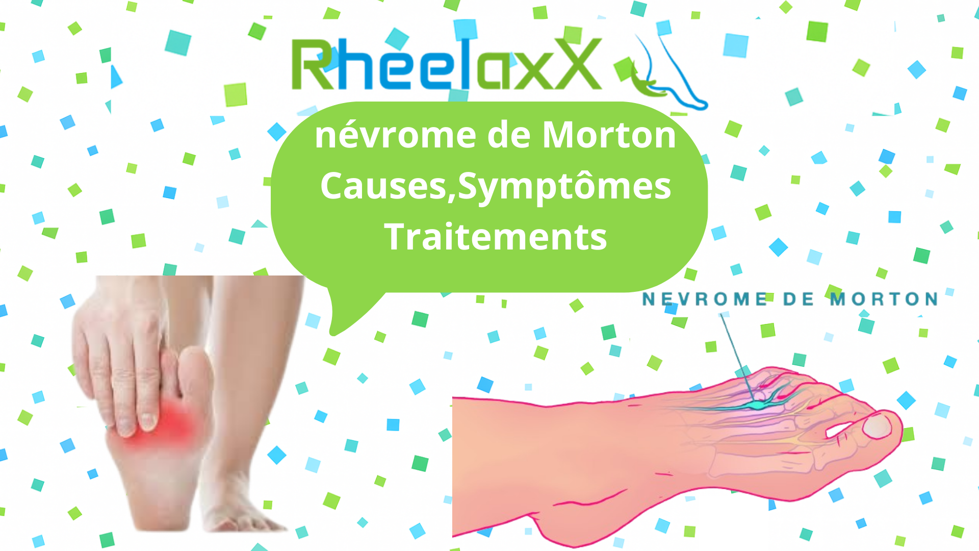 Névrome de Morton : Comprendre, Apaiser et Éviter la Douleur au Pied
